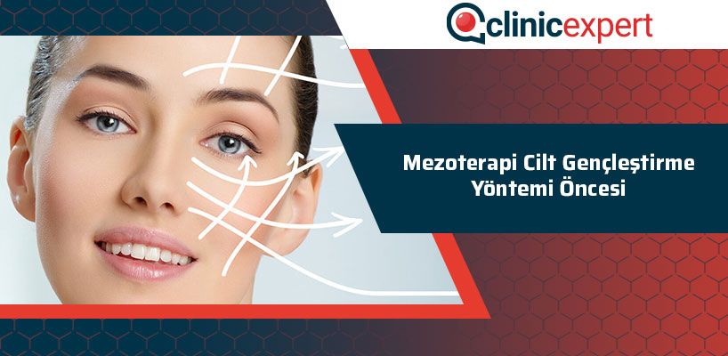 mezoterapi-cilt-genclestirme-yontemi-oncesi-cln