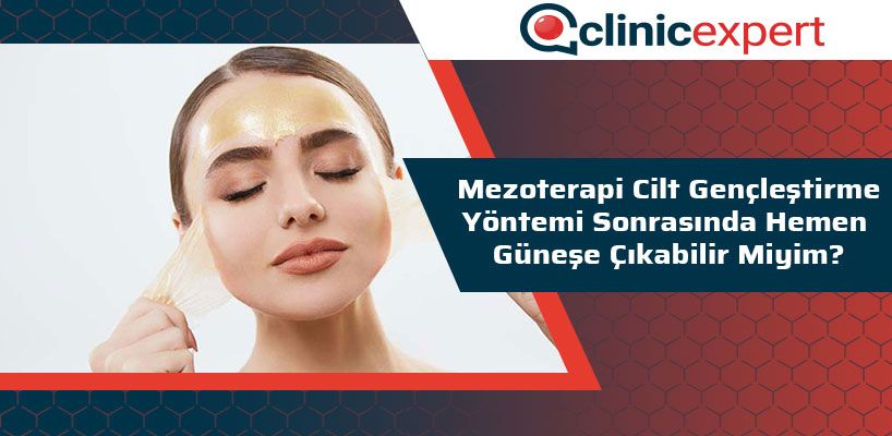 mezoterapi-cilt-genclestirme-yontemi-sonrasinda-hemen-gunese-cikabilir-miyim-cln