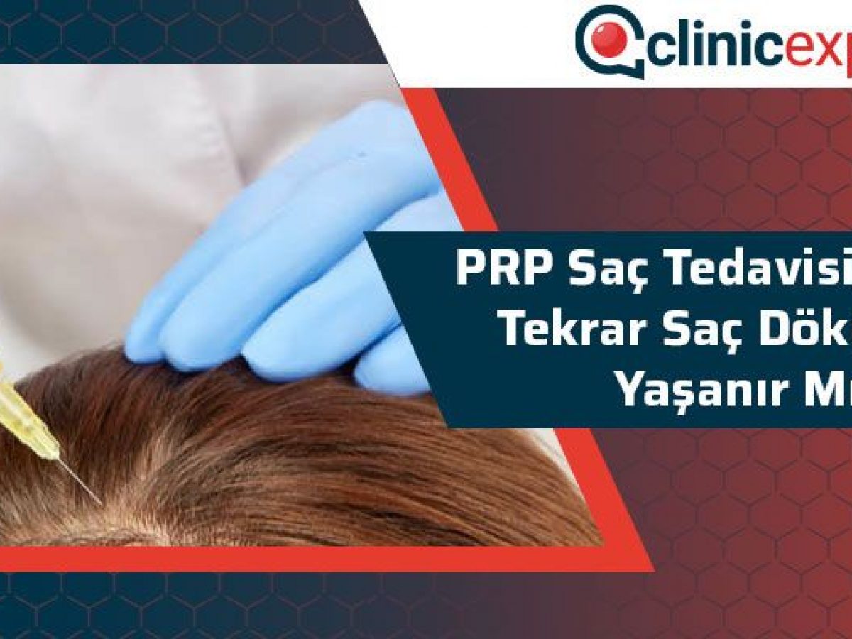 Prp Sac Tedavisi Sonrasi Tekrar Sac Dokulmesi Yasanir Mi Clinicexpert