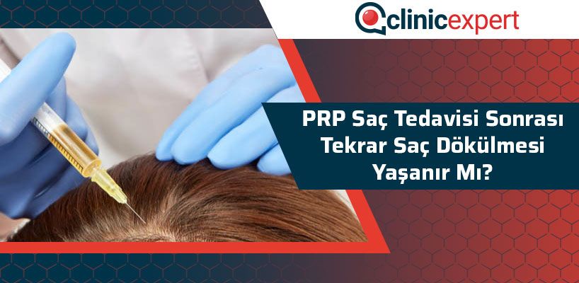 PRP Saç Tedavisi Sonrası Tekrar Saç Dökülmesi Yaşanır Mı?