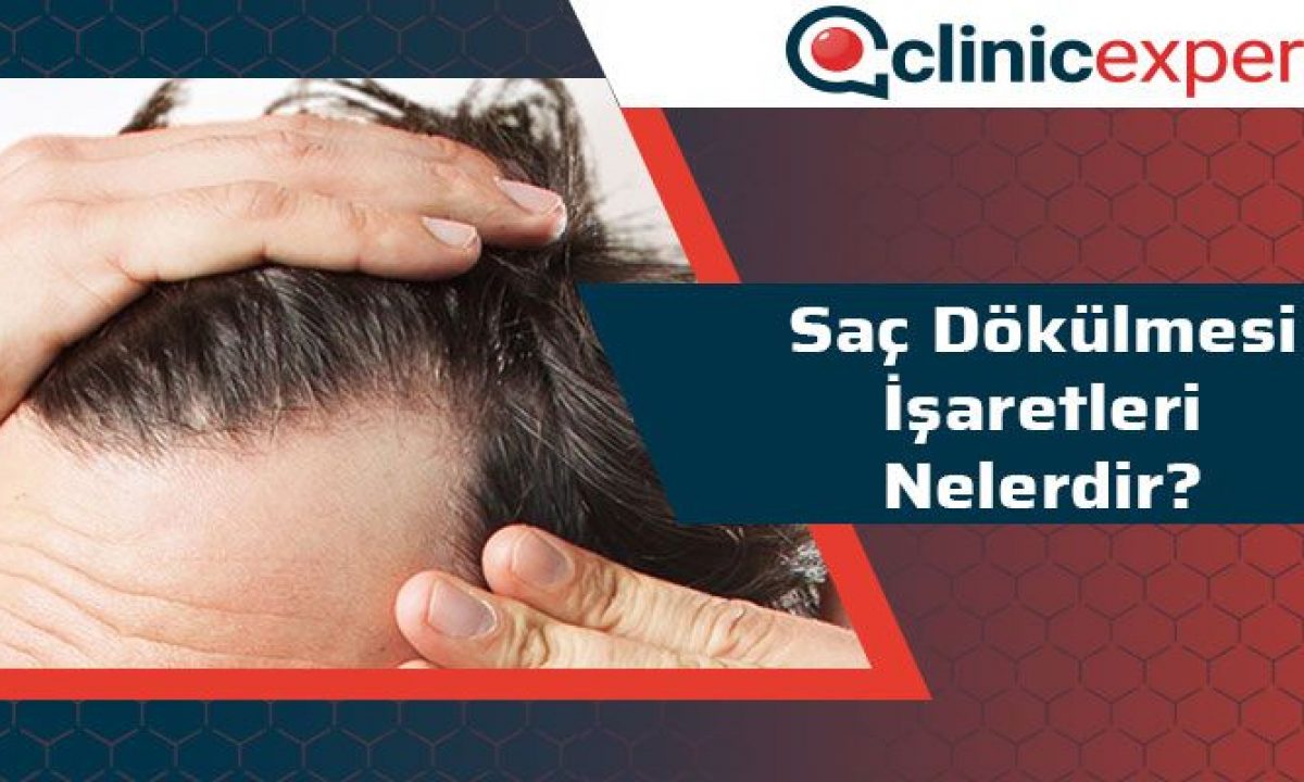 Sac Dokulmesi Isaretleri Nelerdir Clinicexpert Sac Ekim Merkezi