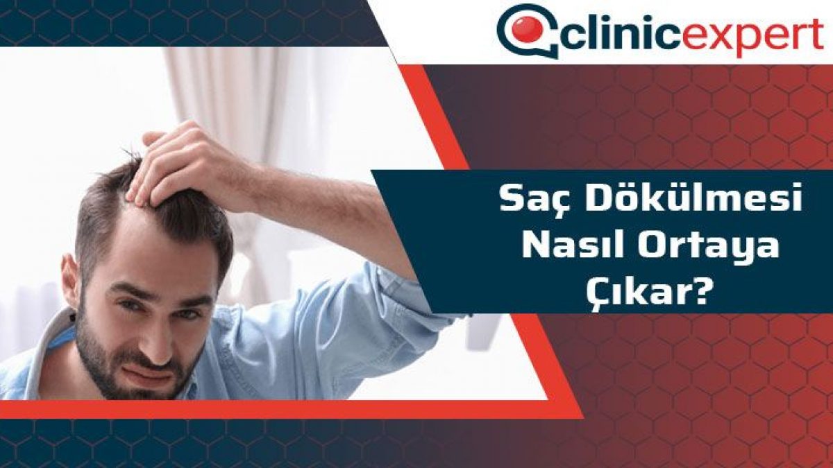 Sac Dokulmesi Nasil Ortaya Cikar Clinicexpert Sac Ekim Merkezi Sac Dokulmesi Nasil Ortaya Cikar Clinicexpert Sac Ekim Merkezi