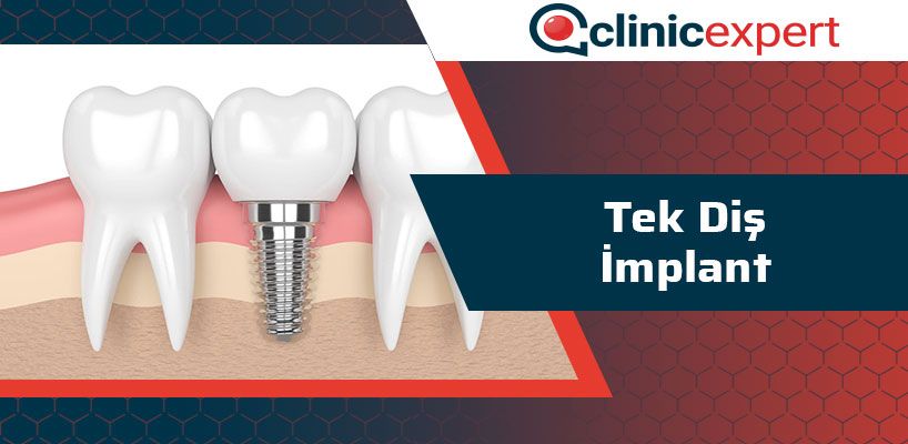 tek-dis-implant-cln