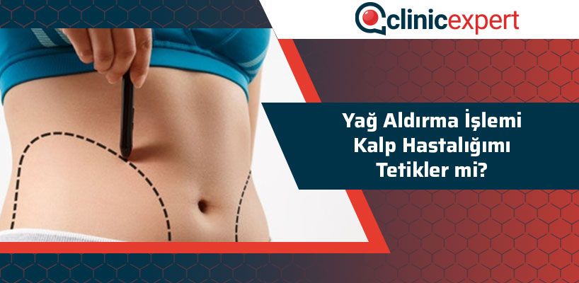 Yağ Aldırma İşlemi Kalp Hastalığımı Tetikler Mi?