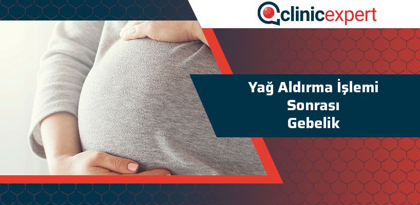 Yağ Aldırma İşlemi Sonrası Gebelik