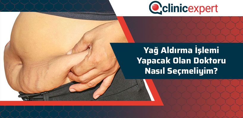 Yağ Aldırma İşlemi Yapacak Olan Doktor Seçiminde İçin 5 Kriter