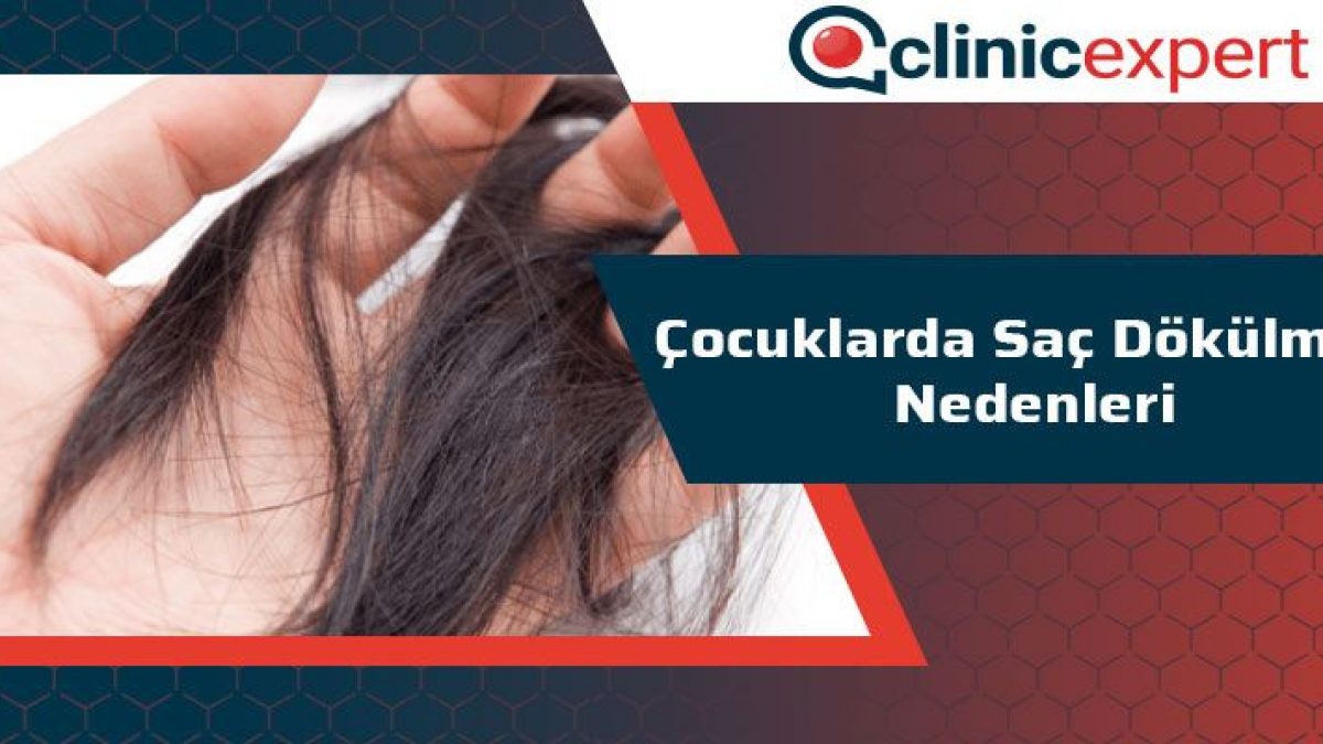 cocuklarda sac dokulmesi nedenleri clinicexpert sac ekim