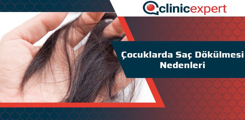 Çocuklarda Saç Dökülmesi Nedenleri