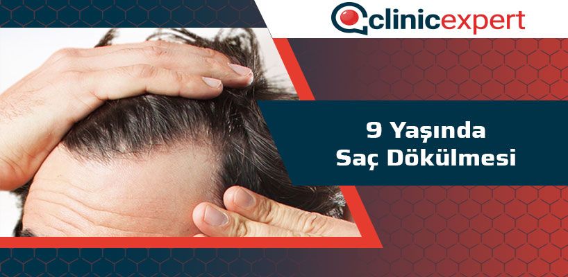 9 Yasinda Sac Dokulmesi Uluslararasi Sac Ekimi Ve Estetik Saglik Hizmetleri Clinic Expert