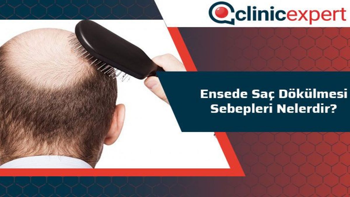 Ensede Sac Dokulmesi Sebepleri Nelerdir Clinicexpert Sac Ekim