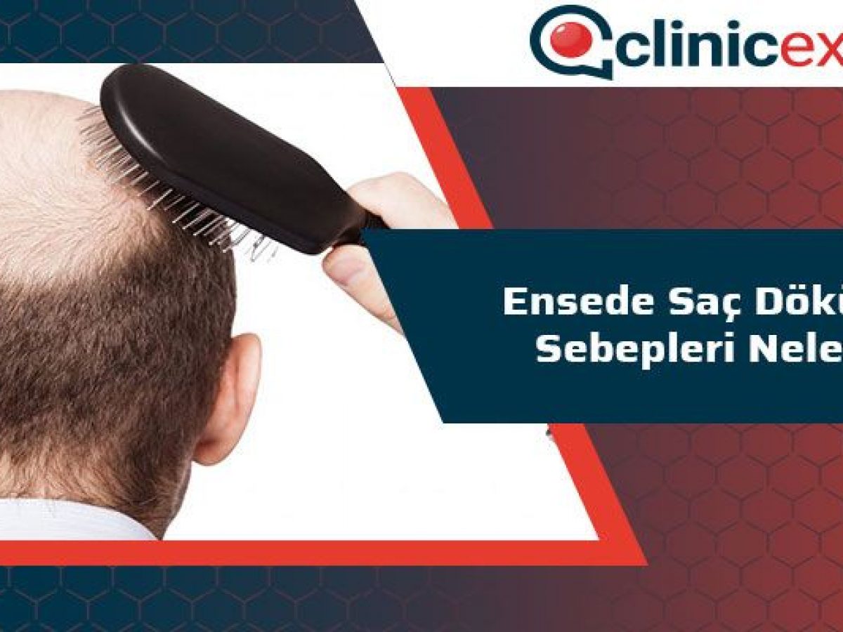 Ensede Sac Dokulmesi Sebepleri Nelerdir Clinicexpert Sac Ekim