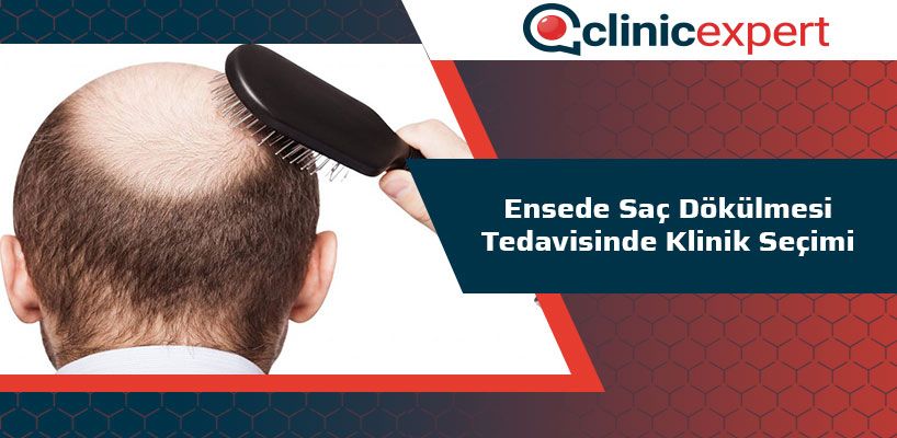 Ensede Saç Dökülmesi Tedavisinde Klinik Seçimi