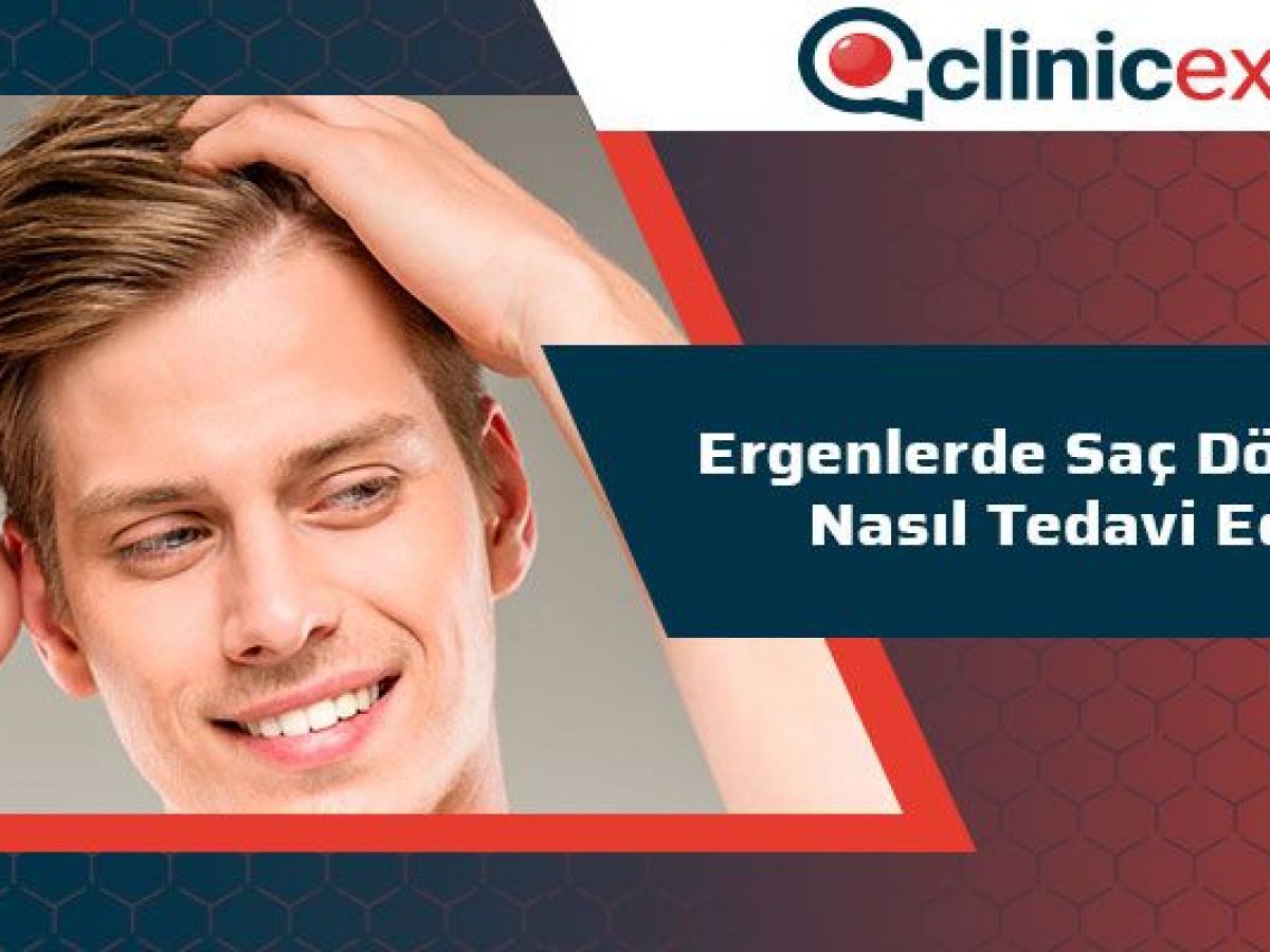 Ergenlerde Sac Dokulmesi Nasil Tedavi Edilir Clinicexpert