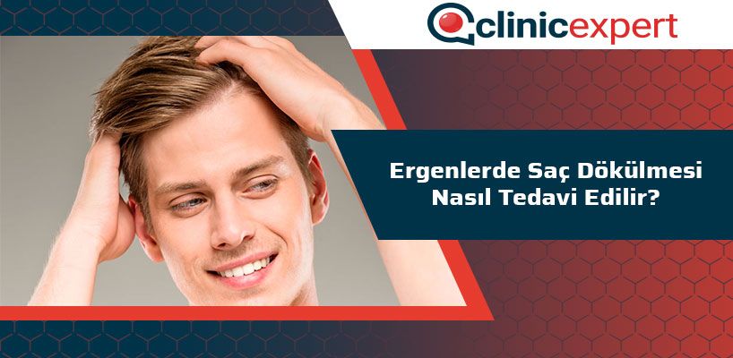 Ergenlerde Sac Dokulmesi Nasil Tedavi Edilir Clinicexpert