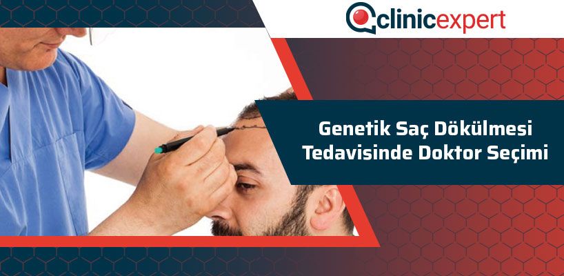 Genetik Saç Dökülmesi Tedavisinde Doktor Seçimi