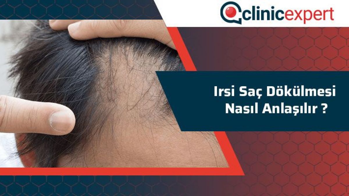 Irsi Sac Dokulmesi Nasil Anlasilir Clinicexpert Com Irsi Sac Dokulmesi Nasil Anlasilir Clinicexpert Com