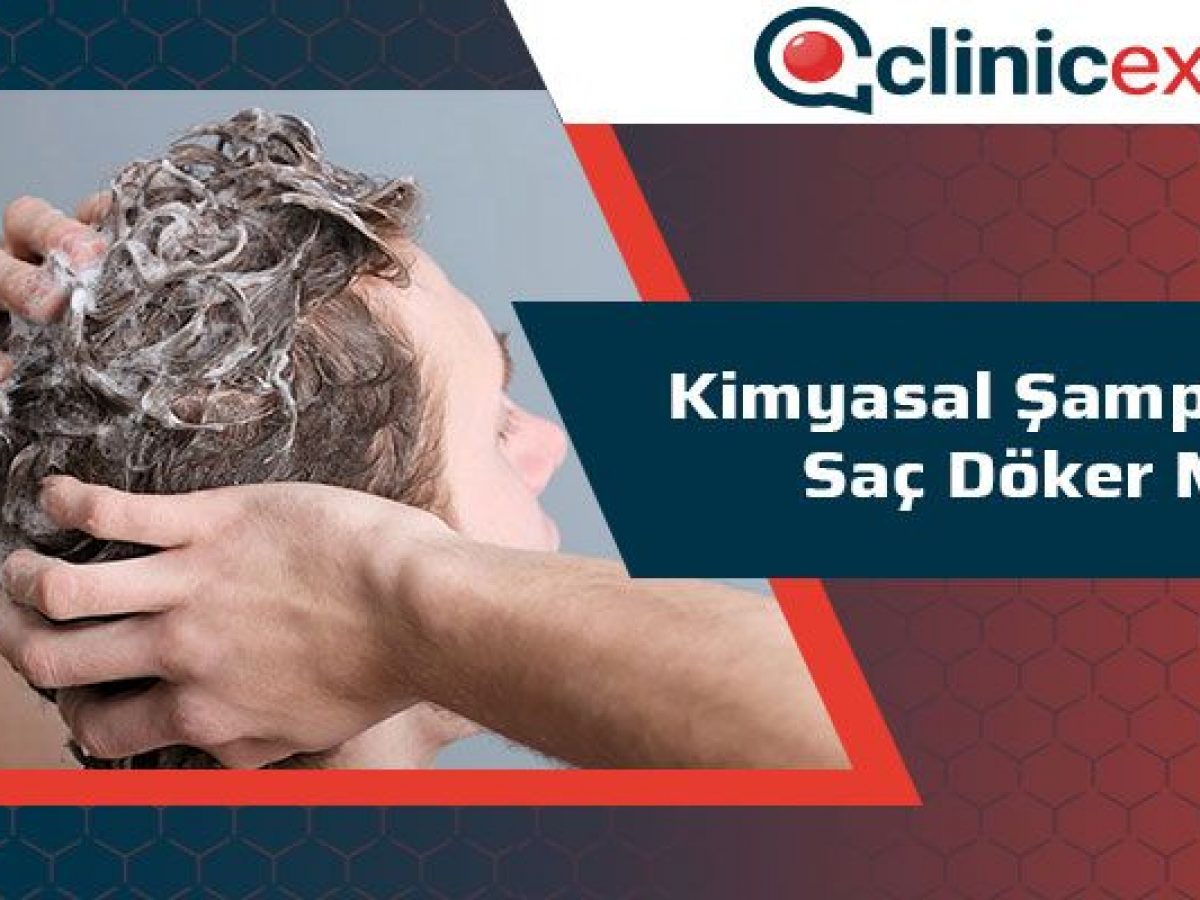 Kimyasal Sampuanlar Sac Doker Mi Clinicexpert Com