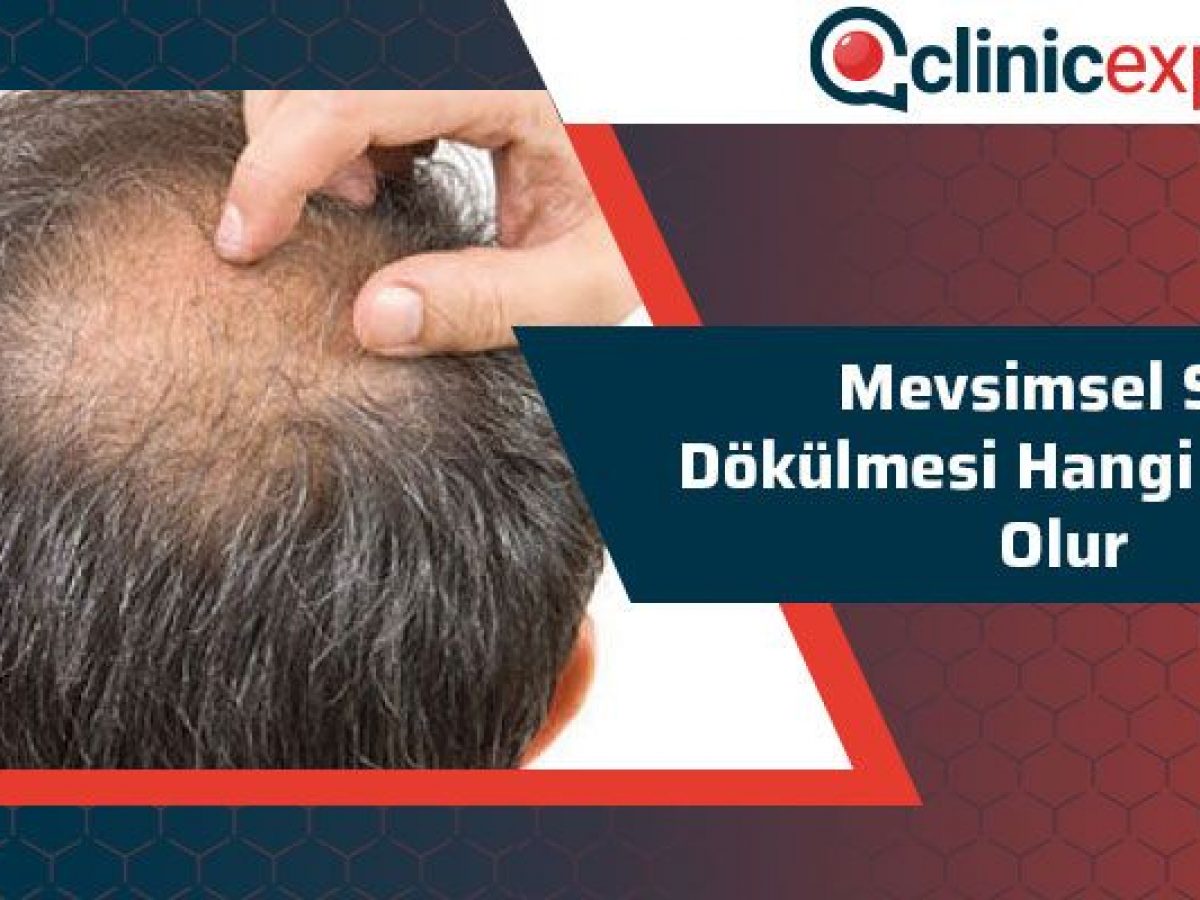 Mevsimsel Sac Dokulmesi Hangi Aylarda Olur
