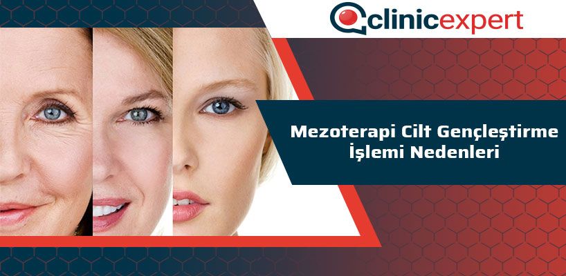 Mezoterapi Cilt Gençleştirme İşlemi Nedenleri