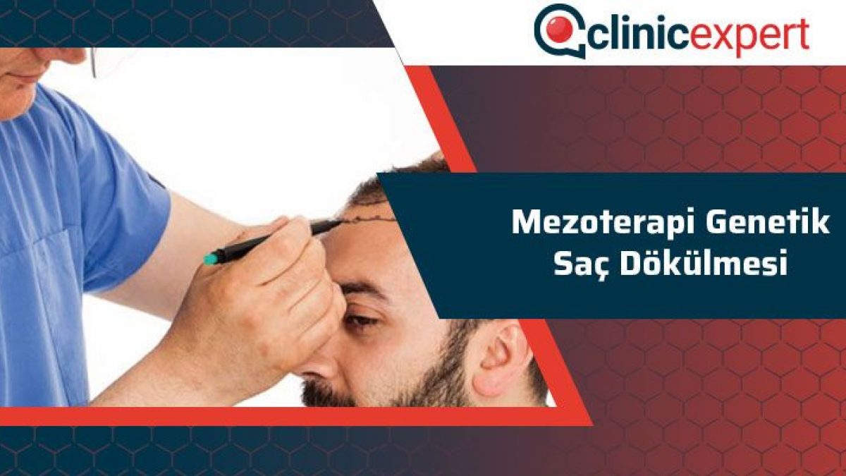 mezoterapi genetik sac dokulmesi clinicexpert com