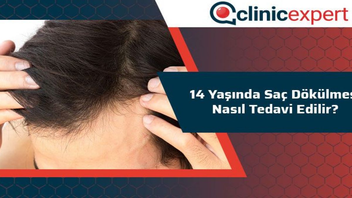 14 Yasinda Sac Dokulmesi Nasil Tedavi Edilir