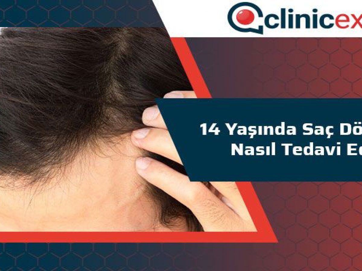 14 Yasinda Sac Dokulmesi Nasil Tedavi Edilir