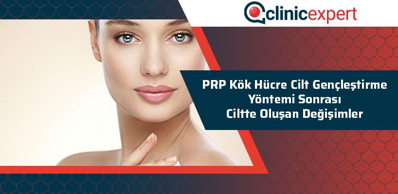 Prp Kök Hücre Cilt Gençleştirme Yöntemi Sonrası Ciltte Oluşan Değişimler