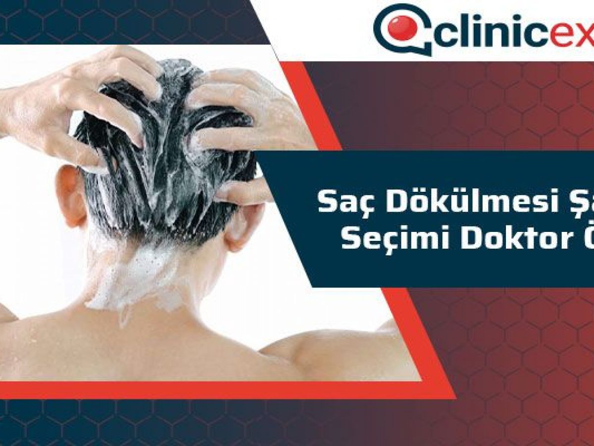 Sac Dokulmesi Sampuan Secimi Doktor Onerisi Sac Dokulmesi Sampuan Secimi Doktor Onerisi