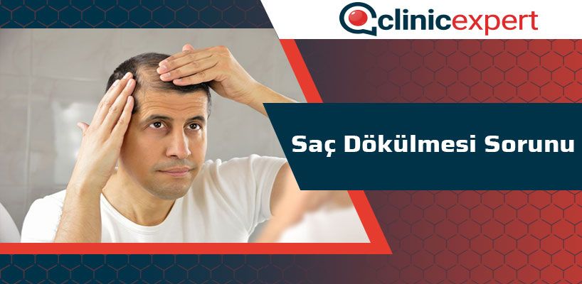 Saç Dökülmesi Sorunu 