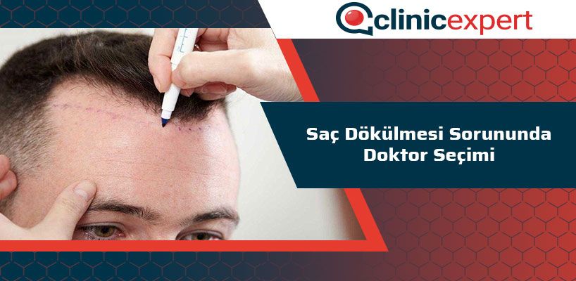 Saç Dökülmesi Sorununda Doktor Seçimi 