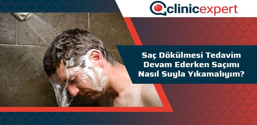 Saç Dökülmesi Tedavim Devam Ederken Saçımı Nasıl Suyla Yıkamalıyım?