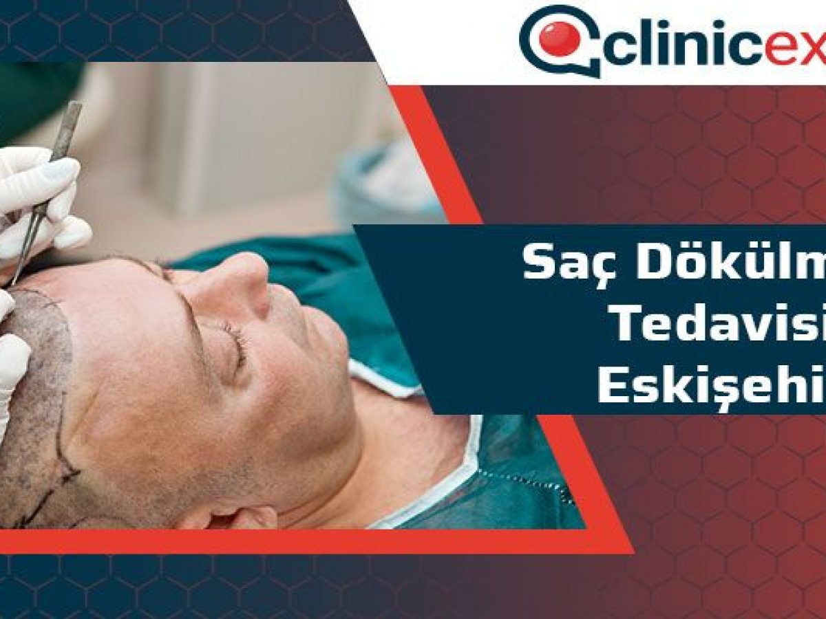 Sac Dokulmesi Tedavisi Eskisehir Clinicexpert Sac Ekim Merkezi