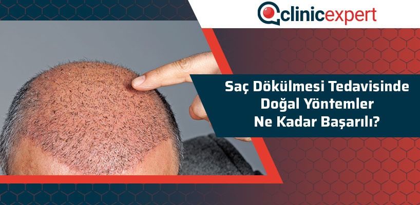 sac-dokulmesi-tedavisinde-dogal-yontemler-ne-kadar-basarili-cln