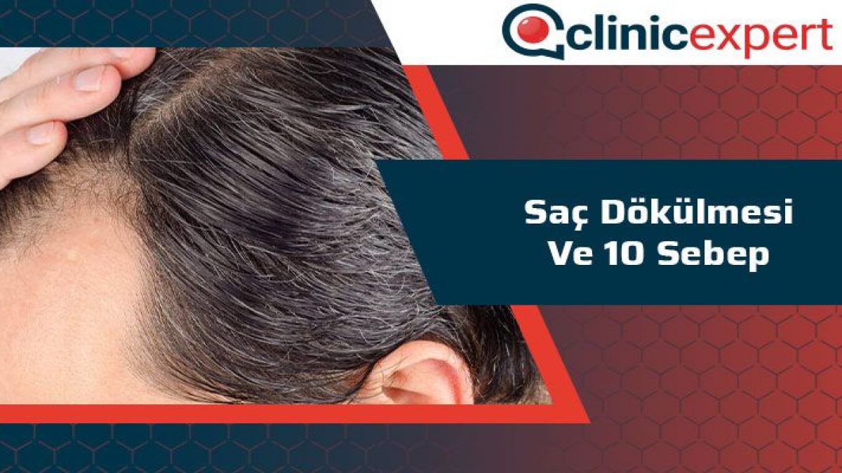 Sac Dokulmesi Ve 10 Sebep Clinicexpert Sac Ekim Merkezi