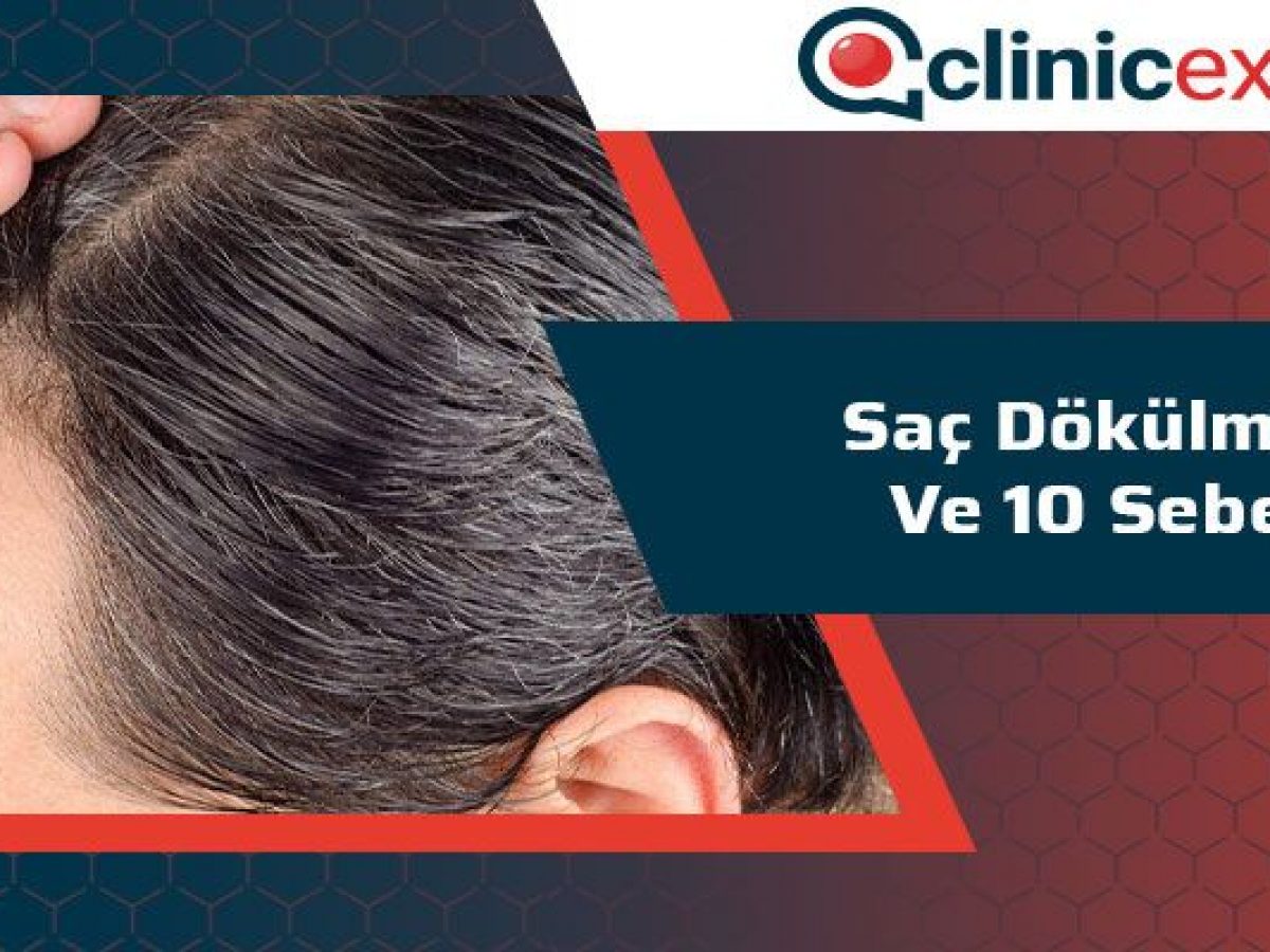 Sac Dokulmesi Ve 10 Sebep Clinicexpert Sac Ekim Merkezi