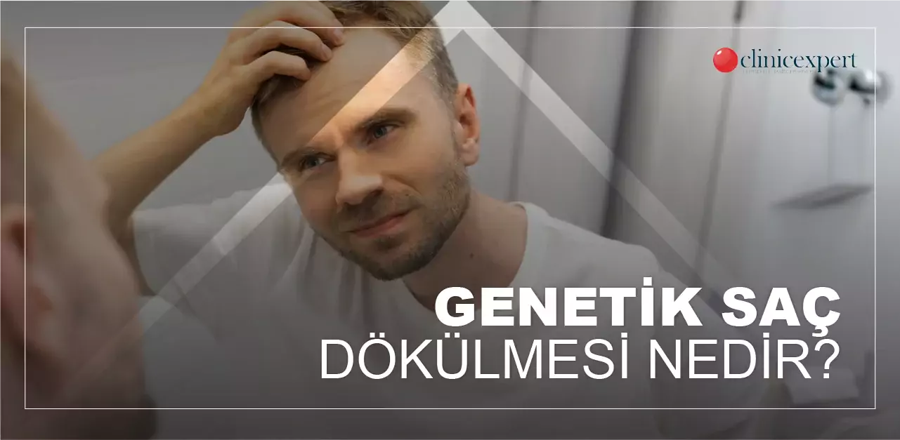 genetik saç dökülmesi