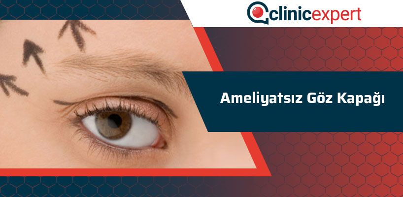 Ameliyatsız Göz Kapağı