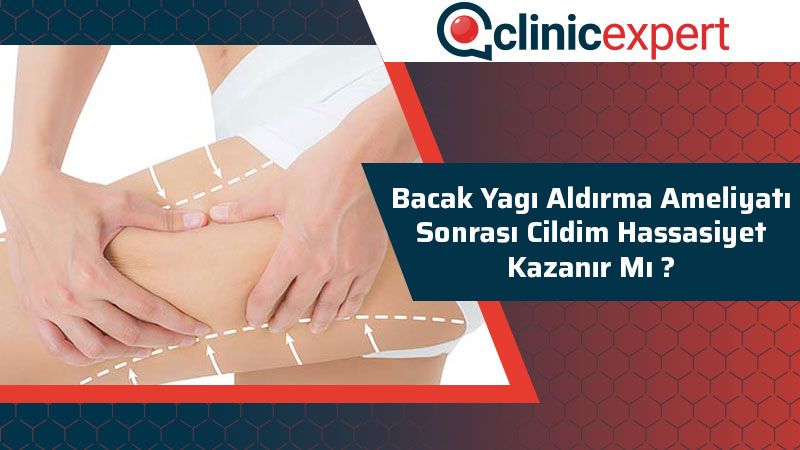 bacak-yagi-aldirma-ameliyati-sonrasi-cildim-hassasiyet-kazanir-mi-cln