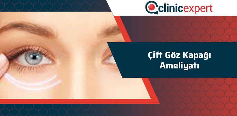 Çift Göz Kapağı Ameliyatı