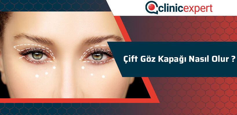 Çift Göz Kapağı Nasıl Olur?