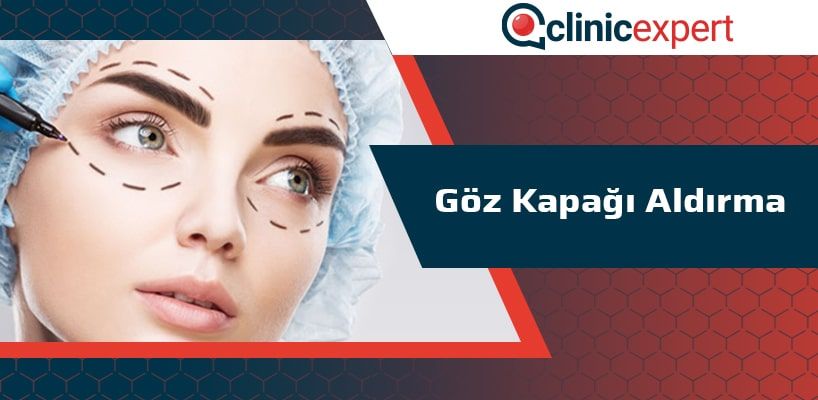 Göz Kapağı Aldırma