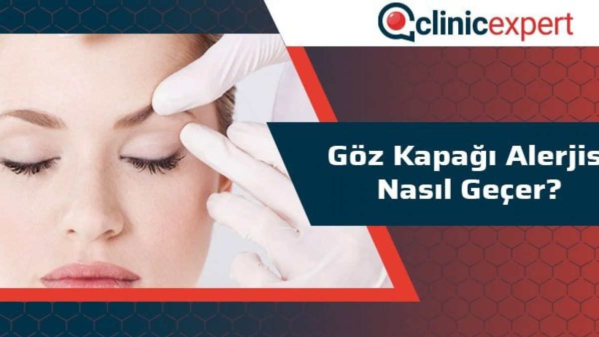 goz kapagi alerjisi nasil gecer goz kapagi alerjisi nasil gecer