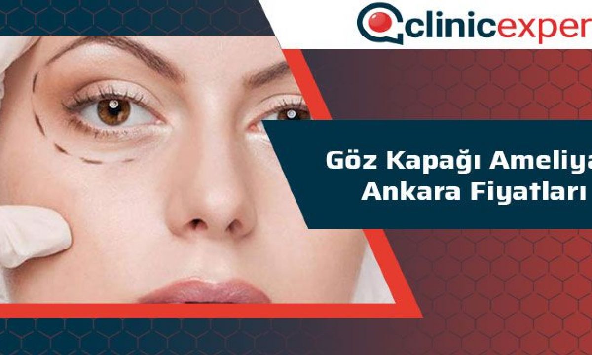 Goz Kapagi Ameliyati Ankara Fiyatlari