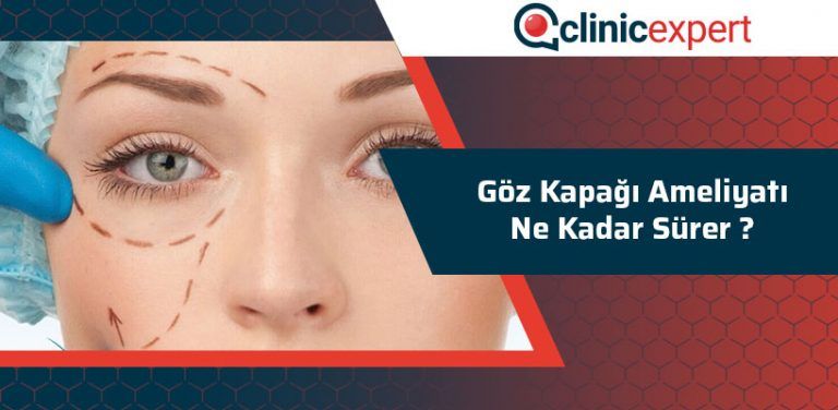 Elexbet Şifremi Güncellemem Ne Kadar Sürer Elexbet Şifremi Güncellemem Ne Kadar Sürer