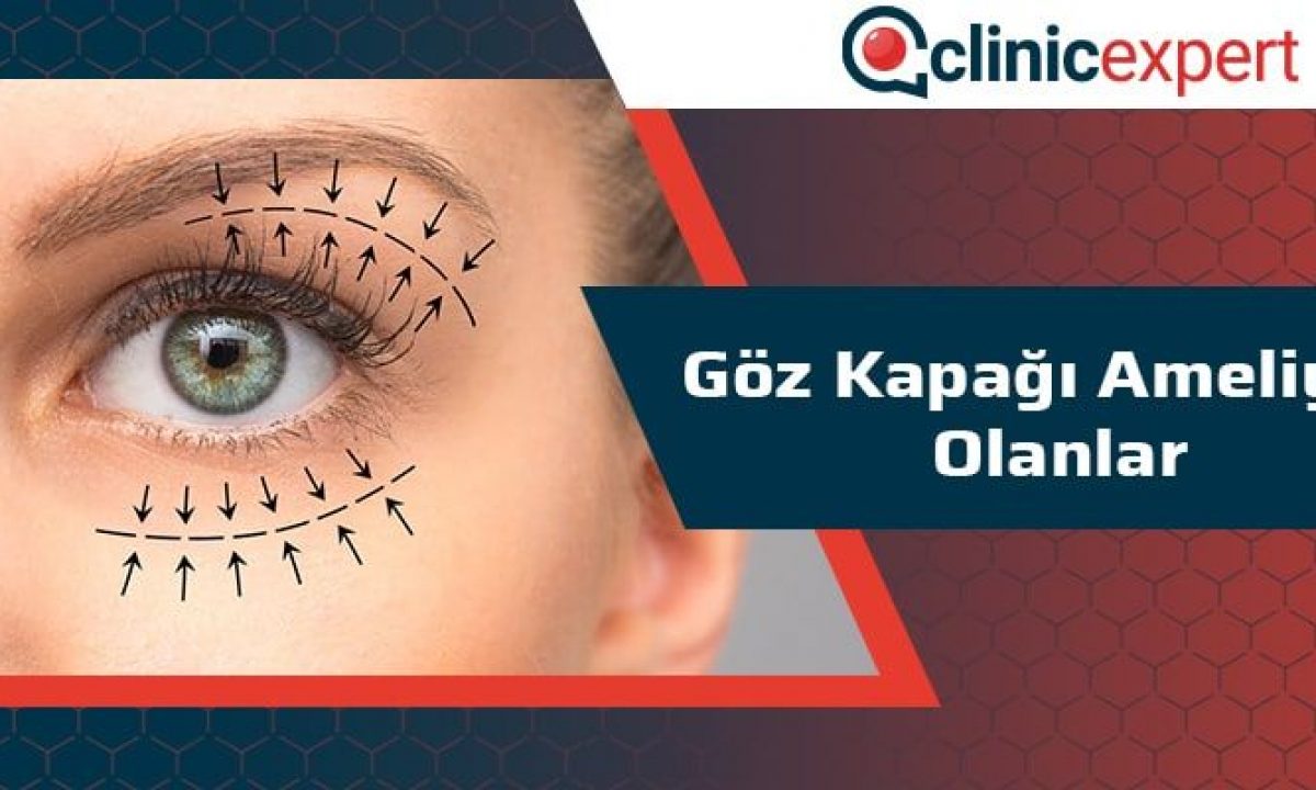 Goz Kapagi Ameliyati Olanlar Clinicexpert Uluslararasi Saglik Hizmetleri