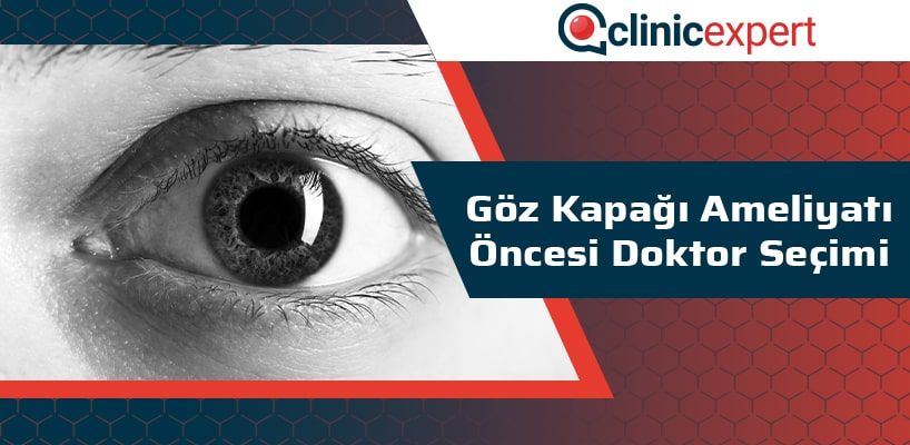 Göz Kapağı Ameliyatı Öncesi Doktor Seçimi