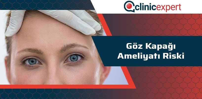 Göz Kapağı Ameliyatı Riski