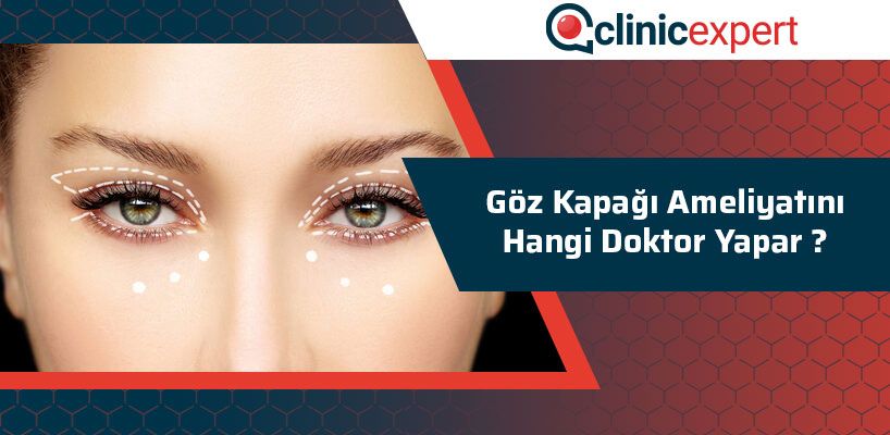 Göz Kapağı Ameliyatını Hangi Doktor Yapar?