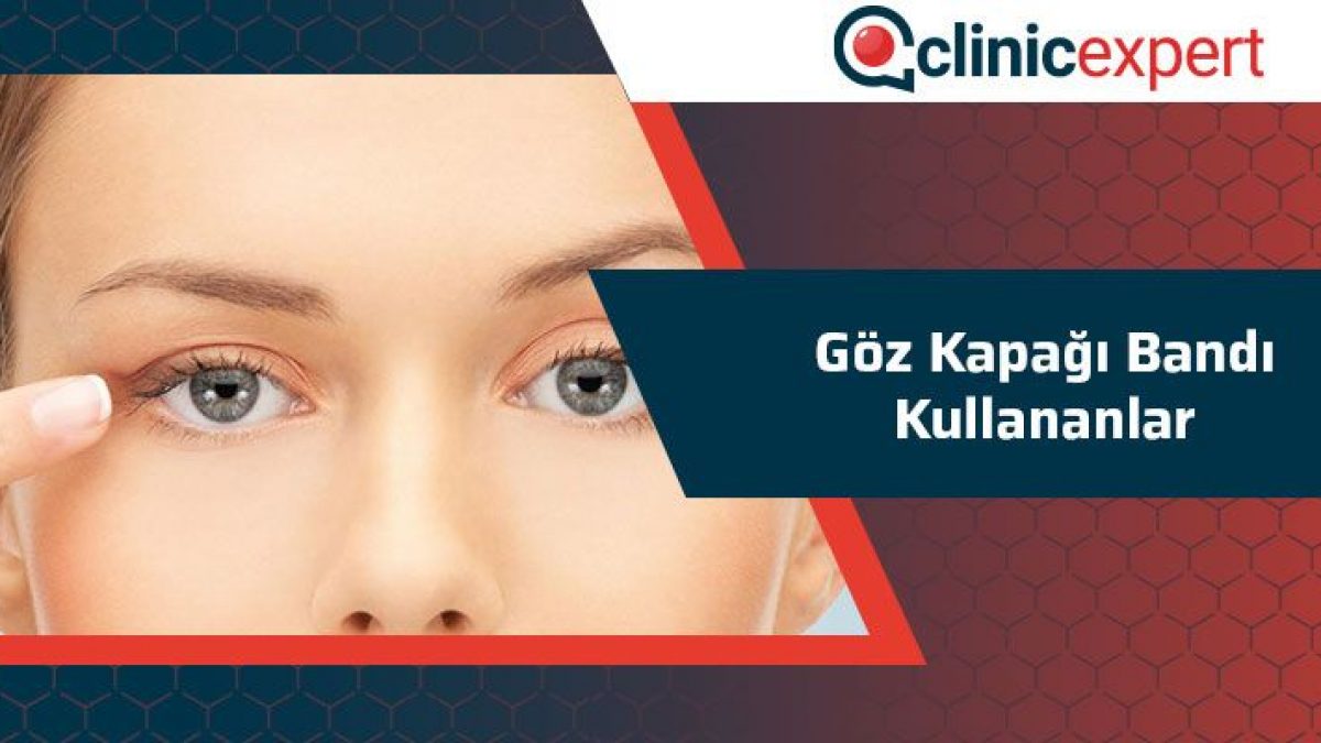 Goz Kapagi Bandi Kullananlar Clinicexpert Uluslararasi Saglik Hizmetleri