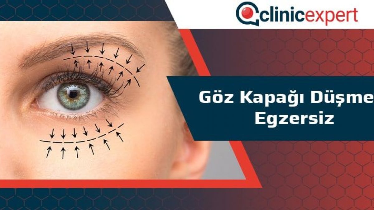 Goz Kapagi Dusmesi Egzersiz Clinicexpert Uluslararasi Saglik Hizmetleri